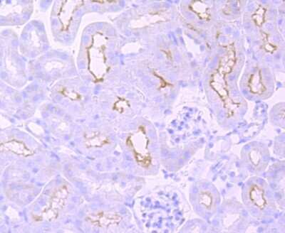 Immunohistochemistry-Paraffin: mGluR1 Antibody (JM11-61) [NBP2-66945] - Analysis of paraffin-embedded mouse kidney tissue using anti-mGluR1 antibody. Counter stained with hematoxylin.