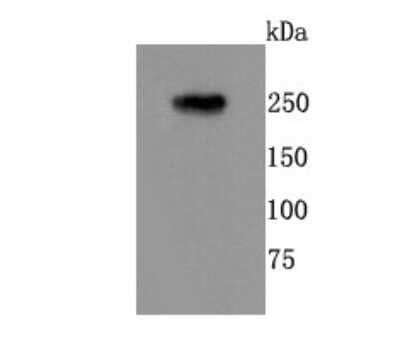 Western Blot: mGluR1 Antibody (JM11-61) [NBP2-66945] - Analysis of mGluR1 on rat brain tissue lysates using anti-mGluR1 antibody at 1/500 dilution.