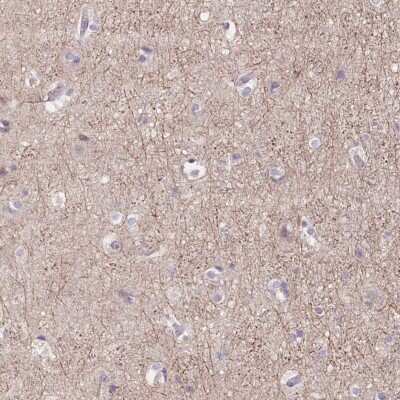 Immunohistochemistry: mGluR2 Antibody [NBP2-49436] - Staining of human cerebral cortex shows moderate positivity in neuropil.