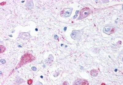 Immunohistochemistry-Paraffin: mGluR2 Antibody [NBP1-02404] -  Staining of human brain, thalamus. Immunohistochemistry of formalin-fixed, paraffin-embedded tissue after heat-induced antigen retrieval. Antibody concentration 4 ug/ml.