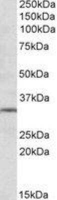 Western Blot: mGluR2 Antibody [NBP1-68855] - Analysis of metabotropic Glutamate Receptor 2 in Human Hippocampus lysate (35ug protein in RIPA buffer) using NBP1-68855 at 1ug/ml. Primary incubation was 1 hour. Detected by chemiluminescence.