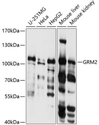 Western Blot: mGluR2 Antibody [NBP3-03722] - Analysis of extracts of various cell lines, using mGluR2 antibody at 1:1000 dilution. Secondary antibody: HRP Goat Anti-Rabbit IgG (H+L) at 1:10000 dilution. Lysates/proteins: 25ug per lane. Blocking buffer: 3% nonfat dry milk in TBST. Detection: ECL Basic Kit