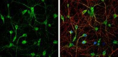 Immunocytochemistry/Immunofluorescence: mGluR3 Antibody [NBP1-31109] - mGluR3 antibody [C3], C-term detects mGluR3 protein by immunofluorescent analysis.Sample: DIV9 rat E18 primary cortical neuron cells were fixed in 4% paraformaldehyde at RT for 15 min.Green: mGluR3 stained by mGluR3 antibody [C3], C-term (NBP1-31109).Red: beta Tubulin 3/ Tuj1, stained by beta Tubulin 3/ Tuj1 antibody.Blue: Fluoroshield with DAPI.