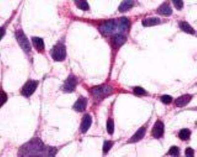 Immunocytochemistry/Immunofluorescence: mGluR3 Antibody [NLS3218] - Analysis of anti-GRM3 / MGLUR3 antibody with transfected HEK293 human embryonic kidney cells.