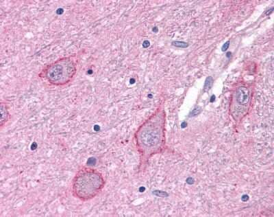 Immunohistochemistry-Paraffin: mGluR3 Antibody [NLS3218] - Analysis of anti-GRM3 / MGLUR3 antibody with human brain, neurons and glia at 9 ug/ml