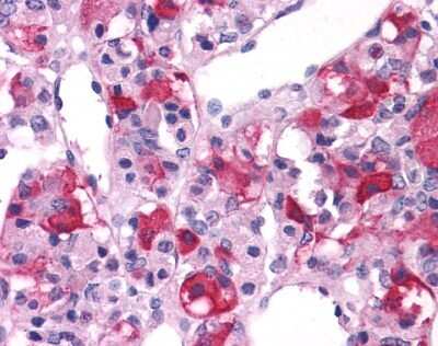 Immunohistochemistry-Paraffin: mGluR3 Antibody [NLS899] - Analysis of anti-GRM3 / MGLUR3 antibody with brain, pituitary at 16 ug/ ml.