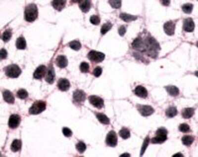 Immunohistochemistry-Paraffin: mGluR3 Antibody [NLS899] - Analysis of anti-GRM3 / MGLUR3 antibody with transfection control at 16 ug/ ml.