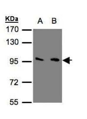 Western Blot: mGluR3 Antibody [NBP1-31109] - (30 ug of whole cell lysate) A: 293T B: A431 7. 5% SDS PAGE, antibody diluted at 1:500.