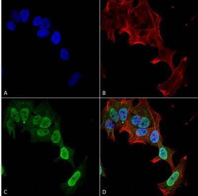 Immunocytochemistry/Immunofluorescence: mGluR5/1a Antibody (S75-33) [NBP2-59334] - Tissue: SK-N-BE Cells (Human Neuroblastoma cells). Species: Human. Fixation: 4% Formaldehyde for 15 min at RT. Primary Antibody: Mouse Anti-mGluR1/5 Monoclonal Antibody at 1:100 for 60 min at RT. Secondary Antibody: Goat Anti-Mouse ATTO 488 at 1:200 for 60 min at RT. Counterstain: Phalloidin Texas Red F-Actin stain; DAPI (blue) nuclear stain at 1:1000, 1:5000 for 60 min at RT, 5 min at RT. Localization: Cell Membrane, Cytoplasm, Nucleus. Magnification: 60X.