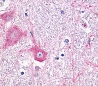 Immunohistochemistry: mGluR5 Antibody [NLS885] - Analysis of anti-GRM5 / MGLUR5 antibody with brain, neurons and glia.