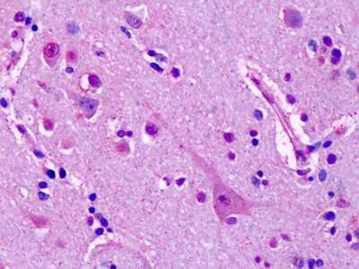 Immunohistochemistry-Paraffin: mGluR7 Antibody [NLS2694] - Analysis of anti-GRM7 / MGLUR7 antibody with human brain, cortex, neurons at dilution 10 ug/ml.