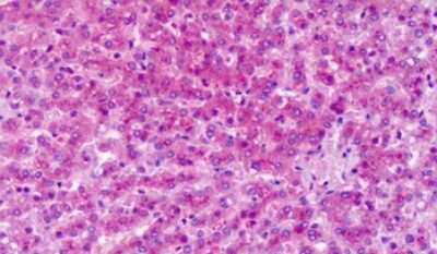 Immunohistochemistry-Paraffin: mGluR7 Antibody [NLS2694] - Anti-GRM7 / MGLUR7 antibody IHC of human liver. Immunohistochemistry of formalin-fixed, paraffin-embedded tissue after heat-induced antigen retrieval. Antibody dilution 10 ug/ml.