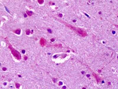 Immunohistochemistry-Paraffin: mGluR7 Antibody [NLS918] - Analysis of anti-GRM7 / MGLUR7 antibody with human brain, cortex at dilution 4-6 ug/ml.