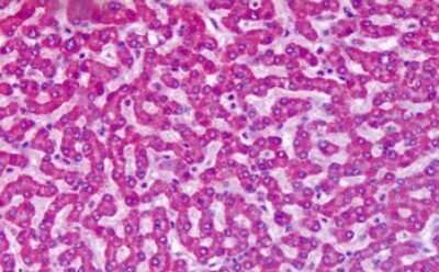 Immunohistochemistry-Paraffin: mGluR7 Antibody [NLS918] - Anti-GRM7 / MGLUR7 antibody IHC of human liver. Immunohistochemistry of formalin-fixed, paraffin-embedded tissue after heat-induced antigen retrieval. Antibody dilution 4-6 ug/ml.