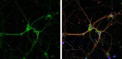Immunocytochemistry/Immunofluorescence: mGluR8 Antibody [NBP2-17278] - DIV9 rat E18 primary cortical neurons cells were fixed in 4% paraformaldehyde at RT for 15 min. Green: mGluR8 stained by mGluR8 antibody [N1], N-term diluted at 1:500. Red: beta Tubulin 3/ Tuj1, stained by beta Tubulin 3/ Tuj1 antibody [1338]  diluted at 1:500. Blue: Fluoroshield with DAPI.