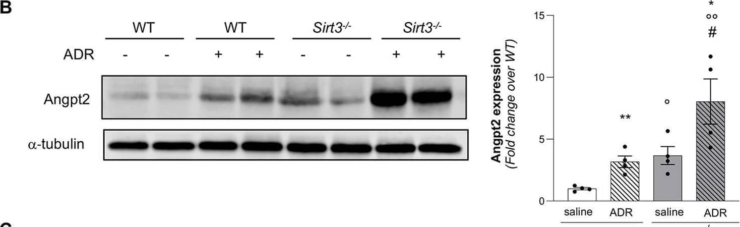 Sirt3 deficiency increases the hypoxic and oxidative state of the kidney and exacerbates ADR-induced oxidative stress.(A) Representative images and quantification of HIF-1 alpha  expression in WT and Sirt3-/- mice after 7 weeks receiving saline or ADR (n = 4 mice for all groups except for n = 3 mice in Sirt3-/-+saline). (B) Representative Western Blot and quantification of Angpt-2 in WT and Sirt3-/- mice, treated with saline or ADR, (n = 4 mice for groups). (C) Representative images and quantification of nitrotyrosine (N-tyrosine) staining in WT and Sirt3-/- mice after 7 weeks receiving saline or ADR (n = 4 mice for all groups). (D) Representative Western Blot and quantification of acetylated SOD2 at lysine 68 (SOD2 AcK) in WT and Sirt3-/- mice, treated with saline or ADR (n = 4 mice for all groups). Data represent mean ± SEM and were analyzed by one-way ANOVA followed by Tukey’s multiple comparisons test. °P<0.05, °°P<0.01, and °°°P<0.001 vs WT+saline. *P<0.05, **P<0.01, and ***P<0.001 vs corresponding saline; #P<0.05, and ###P<0.001 vs WT+ADR. Scale bars, 20 μm. Image collected and cropped by CiteAb from the following open publication (//pubmed.ncbi.nlm.nih.gov/37816025), licensed under a CC-BY license. Not internally tested by R&D Systems.