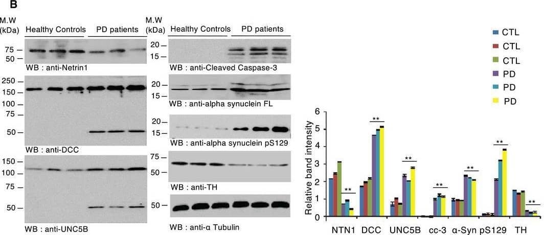 Netrin‐1 is reduced in the SN of PD patientsANetrin‐1 gene expression profiling by array of substantiae nigrae from PD and non‐PD (Control) patients using the GEO dataset GSE7621 that has a total of 25 samples (n = 9 control and n = 16 PD cases). Unpaired t‐test, ***P < 0.0005, Mean ± SD are shown.BImmunoblot of netrin‐1, DCC, UNC5B, active caspase‐3, alpha‐synuclein FL, alpha‐synuclein pS129, and tyrosine hydroxylase (TH) levels in age‐matched controls (n = 3) vs Parkinson’s disease patients brain samples (n = 3) (left panel). Band quantification bar graph (right panel). Bars and error bars represent the mean ± SEM. Statistical significance was determined using a one‐way ANOVA followed by post hoc Tukey test for multiple group comparison. **P < 0.01. N = 3 replicates.Source data are available online for this figure. Image collected and cropped by CiteAb from the following open publication (//pubmed.ncbi.nlm.nih.gov/33351190), licensed under a CC-BY license. Not internally tested by R&D Systems.