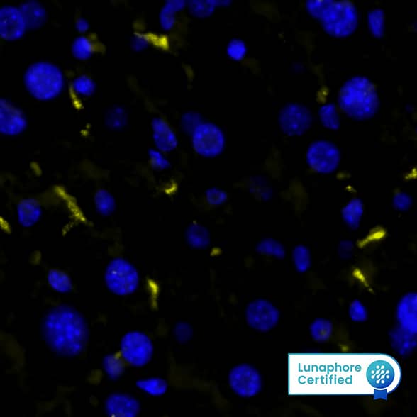 CD68 was detected in immersion fixed paraffin-embedded sections of mouse Liver using Rabbit Anti-Mouse CD68, Monoclonal Antibody (Catalog #MAB101141) at 5ug/mL at 37 ° Celsius for 4 minutes. Before incubation with the primary antibody, tissue underwent an all-in-one dewaxing and antigen retrieval preprocessing using PreTreatment Module (PT Module) and Dewax and HIER Buffer H (pH 9; Epredia Catalog # TA-999-DHBH). Tissue was stained using the Alexa Fluor™ Plus 555 Goat anti-Rabbit IgG Secondary Antibody at 1:100 at 37 ° Celsius for 2 minutes. (Yellow; Lunaphore Catalog # DR555RB) and counterstained with DAPI (blue; Lunaphore Catalog # DR100). Specific staining was localized to the cytoplasm of Kupffer cells. Protocol available in COMET™ Panel Builder.​​