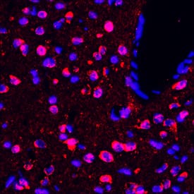 Immunohistochemistry 5-HT1D Antibody (1014728) [Unconjugated]