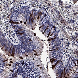 Immunohistochemistry SARS-CoV-2 Spike S1 Protein Antibody (1035206) [Unconjugated]