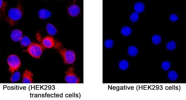 Immunocytochemistry SARS-CoV-2 Spike S1 Protein Antibody (2811A) [Unconjugated]