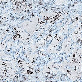 Immunohistochemistry SARS-CoV-2 Spike S1 Protein Antibody (2811A) [Unconjugated]
