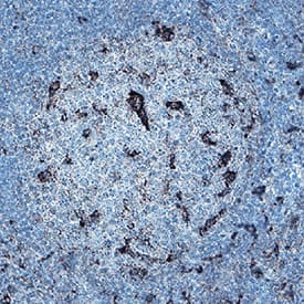 IL-23R was detected in immersion fixed paraffin-embedded sections of human tonsil using Mouse Anti-Cynomolgus Monkey IL-23R Monoclonal Antibody (Catalog # MAB106241) at 5 &micro;g/mL for 1 hour at room temperature followed by incubation with the Anti-Mouse IgG VisUCyte&trade; HRP Polymer Antibody (VC001). Before incubation with the primary antibody, tissue was subjected to heat-induced epitope retrieval using Antigen Retrieval Reagent-Basic (CTS013). Tissue was stained using DAB (brown) and counterstained with hematoxylin (blue). Specific staining was localized to cell surface. Staining was performed using our protocol for IHC Staining with VisUCyte HRP Polymer Detection Reagents.