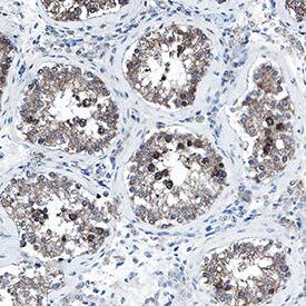 OX40 Ligand/TNFRSF4 was detected in immersion fixed paraffin-embedded sections of human testis using Mouse Anti-Human OX40 Ligand/TNFRSF4 Monoclonal Antibody (Catalog # MAB10656) at 5 &micro;g/mL for 1 hour at room temperature followed by incubation with the Anti-Mouse IgG VisUCyte&trade; HRP Polymer Antibody (VC001). Before incubation with the primary antibody, tissue was subjected to heat-induced epitope retrieval using Antigen Retrieval Reagent-Basic (CTS013). Tissue was stained using DAB (brown) and counterstained with hematoxylin (blue). Specific staining was localized to cell surface in sperm cells. Staining was performed using our protocol for IHC Staining with VisUCyte HRP Polymer Detection Reagents.