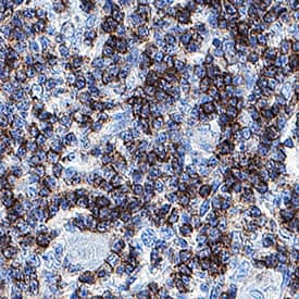 CD3 epsilon  was detected in immersion fixed paraffin-embedded sections of human thymus using Mouse Anti-Human CD3 epsilon  Monoclonal Antibody (Catalog # MAB10670) at 5 &micro;g/mL for 1 hour at room temperature followed by incubation with the Anti-Mouse IgG VisUCyte&trade; HRP Polymer Antibody (VC001). Before incubation with the primary antibody, tissue was subjected to heat-induced epitope retrieval using Antigen Retrieval Reagent-Basic (CTS013). Tissue was stained using DAB (brown) and counterstained with hematoxylin (blue). Specific staining was localized to cell surface in lymphocytes. Staining was performed using our protocol for IHC Staining with VisUCyte HRP Polymer Detection Reagents.