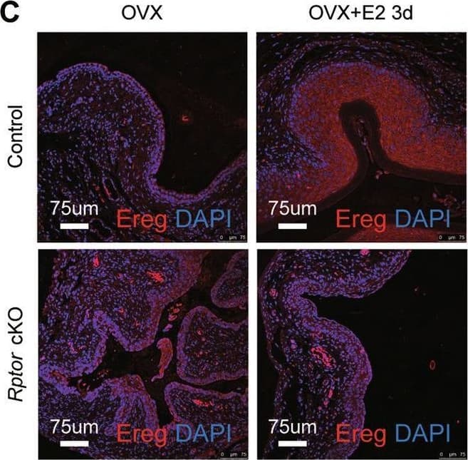 Immunohistochemistry Epiregulin Antibody (189611)