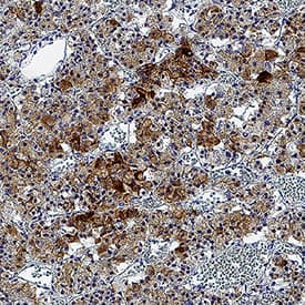 GHRHR was detected in immersion fixed paraffin-embedded sections of human pituitary using Rabbit Anti-Human GHRHR Monoclonal Antibody (Catalog # MAB107353) at 3 &micro;g/mL for 1 hour at room temperature followed by incubation with the Anti-Rabbit IgG VisUCyte&trade; HRP Polymer Antibody (Catalog # VC003). Before incubation with the primary antibody, tissue was subjected to heat-induced epitope retrieval using VisUCyte Antigen Retrieval Reagent-Basic (Catalog # VCTS021). Tissue was stained using DAB (brown) and counterstained with hematoxylin (blue). Specific staining was localized to cytoplasm. View our protocol for IHC Staining with VisUCyte HRP Polymer Detection Reagents.