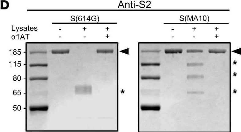 Western Blot SARS-CoV-2 Spike S2 Antibody (2812C) [Unconjugated]