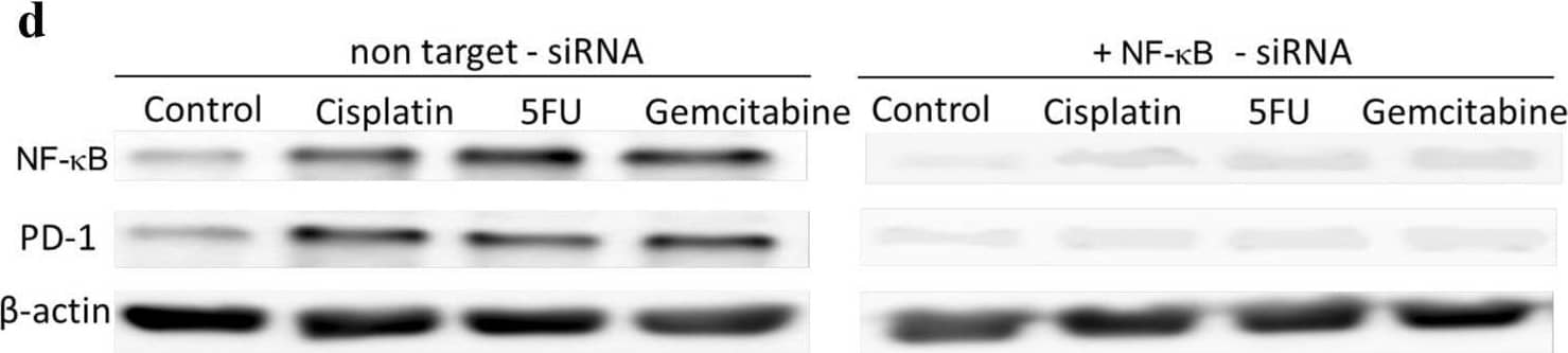 Chemotherapeutics induce PD-L1 expression in NPC cells and PD-1 expression in NK cells via upregulation of NF-kappa B. NPC cells a or NK cells c were incubated with the NF-kappa B inhibitor BMS-345541 for 1 h before incubation with chemotherapeutics. NPC cells were transfected with NF-kappa B siRNA b or NK cells with NF-kappa B siRNA d for 16 h and then incubated with chemotherapeutics. Expression of NF-kappa B, PD-L1 and PD-1 was analyzed by immunoblot Image collected and cropped by CiteAb from the following open publication (//pubmed.ncbi.nlm.nih.gov/32737537), licensed under a CC-BY license. Not internally tested by R&D Systems.