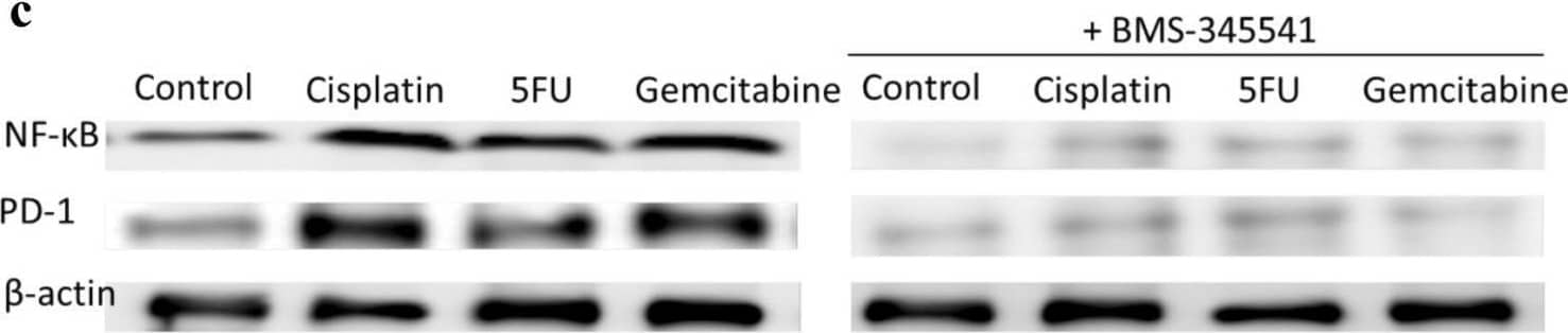 Chemotherapeutics induce PD-L1 expression in NPC cells and PD-1 expression in NK cells via upregulation of NF-kappa B. NPC cells a or NK cells c were incubated with the NF-kappa B inhibitor BMS-345541 for 1 h before incubation with chemotherapeutics. NPC cells were transfected with NF-kappa B siRNA b or NK cells with NF-kappa B siRNA d for 16 h and then incubated with chemotherapeutics. Expression of NF-kappa B, PD-L1 and PD-1 was analyzed by immunoblot Image collected and cropped by CiteAb from the following open publication (//pubmed.ncbi.nlm.nih.gov/32737537), licensed under a CC-BY license. Not internally tested by R&D Systems.