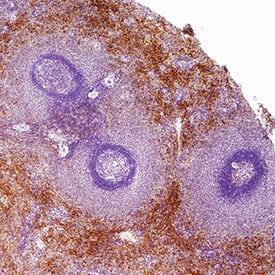 DNAM-1/CD226 was detected in immersion fixed paraffin-embedded sections of human spleen using Rabbit Anti-Human DNAM-1/CD226 Monoclonal Antibody (Catalog # MAB108921) at 3 &micro;g/mL for 1 hour at room temperature followed by incubation with the Anti-Rabbit IgG VisUCyte&trade; HRP Polymer Antibody (Catalog # VC003). Before incubation with the primary antibody, tissue was subjected to heat-induced epitope retrieval using VisUCyte Antigen Retrieval Reagent-Basic (Catalog # VCTS021). Tissue was stained using DAB (brown) and counterstained with hematoxylin (blue). Specific staining was localized to cytoplasm in epithelial cells. View our protocol for IHC Staining with VisUCyte HRP Polymer Detection Reagents.