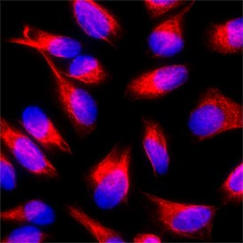 Biotin was detected in immersion fixed HeLa cells using Rabbit Anti-Biotin Monoclonal Antibody (Catalog # MAB10915) at 8 &micro;g/mL for 3 hours at room temperature. Cells were stained using the NorthernLights&trade; 557-conjugated Anti-Rat IgG Secondary Antibody (red; Catalog # NL013) and counterstained with DAPI (blue). Specific staining was localized to cytoplasm. View our protocol for Fluorescent ICC Staining of Cells on Coverslips.