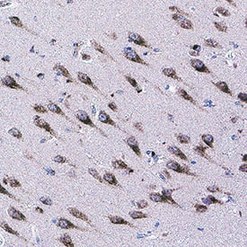 FFAR1/GPR40 was detected in immersion fixed paraffin-embedded sections of human brain hypothalamus using Mouse Anti-Human FFAR1/GPR40 Monoclonal Antibody (Catalog # MAB11025) at 5 &micro;g/mL for 1 hour at room temperature followed by incubation with the Anti-Mouse IgG VisUCyte&trade; HRP Polymer Antibody (Catalog # VC001). Before incubation with the primary antibody, tissue was subjected to heat-induced epitope retrieval using VisUCyte Antigen Retrieval Reagent-Basic (Catalog # VCTS021). Tissue was stained using DAB (brown) and counterstained with hematoxylin (blue). Specific staining was localized to cytoplasm in neurons. View our protocol for IHC Staining with VisUCyte HRP Polymer Detection Reagents.