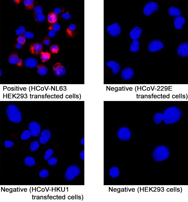 HCoV-NL63 Spike RBD was detected in immersion fixed HEK293 human embryonic kidney cell line transfected (positive staining) and HEK293 human embryonic kidney cell line (non-transfected, or HCoV-229E or HCoV-HKU1 transfected, negative staining) using Mouse Anti-HCoV-NL63 Human Coronavirus Spike RBD Monoclonal Antibody (Catalog # MAB11037) at 8 &micro;g/mL for 3 hours at room temperature. Cells were stained using the NorthernLights&trade; 557-conjugated Anti-Mouse IgG Secondary Antibody (red; Catalog # NL007) and counterstained with DAPI (blue). Specific staining was localized to cytoplasm. View our protocol for Fluorescent ICC Staining of Cells on Coverslips.
