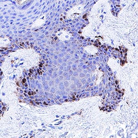 FGFR2 alpha was detected in immersion fixed paraffin-embedded sections of Skin using Mouse Anti-Human FGFR2 alpha Monoclonal Antibody (Catalog # MAB111191) at 5 &micro;g/mL for 1 hour at room temperature followed by incubation with the Anti-Mouse IgG VisUCyte&trade; HRP Polymer Antibody (Catalog # VC001). Before incubation with the primary antibody, tissue was subjected to heat-induced epitope retrieval using VisUCyte Antigen Retrieval Reagent-Basic (Catalog # VCTS021). Tissue was stained using DAB (brown) and counterstained with hematoxylin (blue). Specific staining was localized to keratinocytes. View our protocol for IHC Staining with VisUCyte HRP Polymer Detection Reagents.