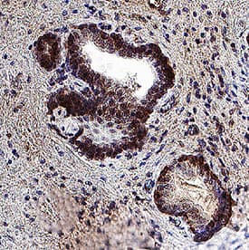 GPR108 was detected in immersion fixed paraffin-embedded sections of human prostate using Mouse Anti-Human GPR108 Monoclonal Antibody (Catalog # MAB11128) at 5 µg/mL for 1 hour at room temperature followed by incubation with the Anti-Mouse IgG VisUCyte™ HRP Polymer Antibody (Catalog # VC001). Before incubation with the primary antibody, tissue was subjected to heat-induced epitope retrieval using VisUCyte Antigen Retrieval Reagent-Basic (Catalog # VCTS021). Tissue was stained using DAB (brown) and counterstained with hematoxylin (blue). Specific staining was localized to cell surface and cytoplasm in glandular epithelial cells. View our protocol for IHC Staining with VisUCyte HRP Polymer Detection Reagents.