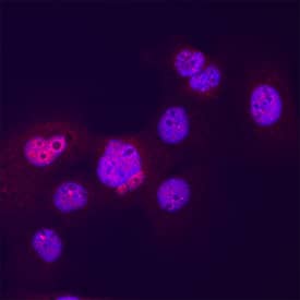 UBE2I/Ubc9 was detected in immersion fixed A431 cells using Mouse Anti-Human UBE2I/Ubc9 Monoclonal Antibody (Catalog # MAB11185) at 8 &micro;g/mL for 3 hours at room temperature. Cells were stained using the NorthernLights&trade; 557-conjugated Anti-Rat IgG Secondary Antibody (red; Catalog # NL013) and counterstained with DAPI (blue). Specific staining was localized to Nuclei. View our protocol for Fluorescent ICC Staining of Cells on Coverslips.