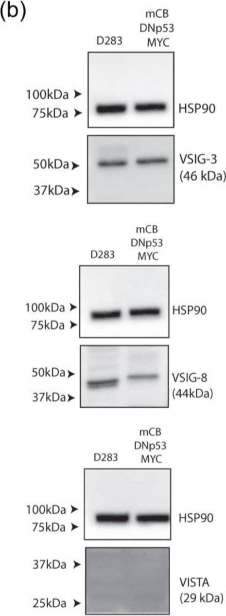 Human and mouse MB tumor cells exhibit in vitro expression of VISTA binding partners and are translationally relevant. (a) Cells gated on live singlets, then further gated based on GFP expression. Histograms (blue) representing in vitro expression of VSIG8 and VSIG3 in human MB cell lines (D283-MED and D425-MED) and our GFP+ mouse medulloblastoma cell line (mCB DNp53 MYC). Fluorescence minus one control represented in gray, and isotype control represented in green. (b) Western blot analysis confirming expression of VSIG3 and VSIG8 and relative absence of VISTA from human and mouse medulloblastoma tumor cell lines (n = 3). Uncropped blots are shown in File S2. (c) Transcriptome analysis of 52 human MB patient samples. X-axis represents quartile distribution of VISTA expression levels: Q1 (lowest 25%), Q2 (next 25%), Q3 (third 25%), and Q4 (highest 25%). Y-axis represents log2 [TPM+1]. Bar graphs representing VISTA transcript (C10orf54) expression correlation with VSIG3, VSIG8, and PSGL1 and LRIG1. Error bars represent standard error of the mean (SEM), and p-values were calculated using a Mann–Whitney test and corrected for multiple comparisons. The asterisks indicate adjusted p-values as follows: * padj < 0.05, ** padj < 0.01. Image collected and cropped by CiteAb from the following open publication (//pubmed.ncbi.nlm.nih.gov/39123357), licensed under a CC-BY license. Not internally tested by R&D Systems.