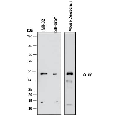 Human and mouse MB tumor cells exhibit in vitro expression of VISTA binding partners and are translationally relevant. (a) Cells gated on live singlets, then further gated based on GFP expression. Histograms (blue) representing in vitro expression of VSIG8 and VSIG3 in human MB cell lines (D283-MED and D425-MED) and our GFP+ mouse medulloblastoma cell line (mCB DNp53 MYC). Fluorescence minus one control represented in gray, and isotype control represented in green. (b) Western blot analysis confirming expression of VSIG3 and VSIG8 and relative absence of VISTA from human and mouse medulloblastoma tumor cell lines (n = 3). Uncropped blots are shown in File S2. (c) Transcriptome analysis of 52 human MB patient samples. X-axis represents quartile distribution of VISTA expression levels: Q1 (lowest 25%), Q2 (next 25%), Q3 (third 25%), and Q4 (highest 25%). Y-axis represents log2 [TPM+1]. Bar graphs representing VISTA transcript (C10orf54) expression correlation with VSIG3, VSIG8, and PSGL1 and LRIG1. Error bars represent standard error of the mean (SEM), and p-values were calculated using a Mann–Whitney test and corrected for multiple comparisons. The asterisks indicate adjusted p-values as follows: * padj HAF008). A specific band was detected for VSIG3 at approximately 46 kDa (as indicated). This experiment was conducted under reducing conditions and using Western Blot Buffer Group 1.