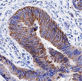 PTGDR was detected in immersion fixed paraffin-embedded sections of Human Colon using Mouse Anti-Human PTGDR Monoclonal Antibody (Catalog # MAB11249) at 5 &micro;g/mL for 1 hour at room temperature followed by incubation with the Anti-Mouse IgG VisUCyte&trade; HRP Polymer Antibody (Catalog # VC001). Before incubation with the primary antibody, tissue was subjected to heat-induced epitope retrieval using VisUCyte Antigen Retrieval Reagent-Basic (Catalog # VCTS021). Tissue was stained using DAB (brown) and counterstained with hematoxylin (blue). Specific staining was localized to cell surface in epithelial cells. View our protocol for IHC Staining with VisUCyte HRP Polymer Detection Reagents.