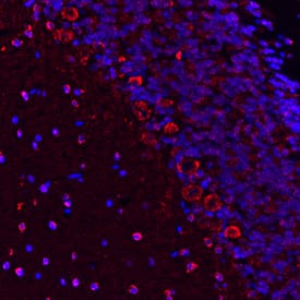 Immunohistochemistry 5-HT2B Antibody (2880B) [Unconjugated]