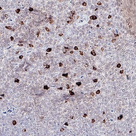 Perforin was detected in immersion fixed paraffin-embedded sections of Human Tonsil using Rabbit Anti-Human Perforin Monoclonal Antibody (Catalog # MAB11298) at 5 &micro;g/mL for 1 hour at room temperature followed by incubation with the Anti-Rabbit IgG VisUCyte&trade; HRP Polymer Antibody (Catalog # VC003). Before incubation with the primary antibody, tissue was subjected to heat-induced epitope retrieval using VisUCyte Antigen Retrieval Reagent-Basic (Catalog # VCTS021). Tissue was stained using DAB (brown) and counterstained with hematoxylin (blue). Specific staining was localized to cytoplasm in lymphocytes. View our protocol for IHC Staining with VisUCyte HRP Polymer Detection Reagents.
