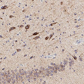 KA2/GRIK5 was detected in immersion fixed paraffin-embedded sections of Human Brain Hippocampus using Rabbit Anti-Human KA2/GRIK5 Monoclonal Antibody (Catalog # MAB113341) at 5 µg/mL for 1 hour at room temperature followed by incubation with the Anti-Rabbit IgG VisUCyte™ HRP Polymer Antibody (Catalog # VC003). Before incubation with the primary antibody, tissue was subjected to heat-induced epitope retrieval using VisUCyte Antigen Retrieval Reagent-Basic (Catalog # VCTS021). Tissue was stained using DAB (brown) and counterstained with hematoxylin (blue). Specific staining was localized to cytoplasm in neurons. View our protocol for IHC Staining with VisUCyte HRP Polymer Detection Reagents.