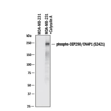 Western blot shows lysates of MDA&amp;#x2011;MB&amp;#x2011;231 human breast cancer cells and MDA-MB-231 + Calyculin A. PVDF membrane was probed with 1&amp;nbsp;µg/mL of Rabbit Anti-Human CNAP1/CEP250 Monoclonal Antibody (Catalog # MAB11339) followed by HRP-conjugated Anti-Rabbit IgG Secondary Antibody (Catalog&amp;#160;# &lt;a class=NoLineLink href=