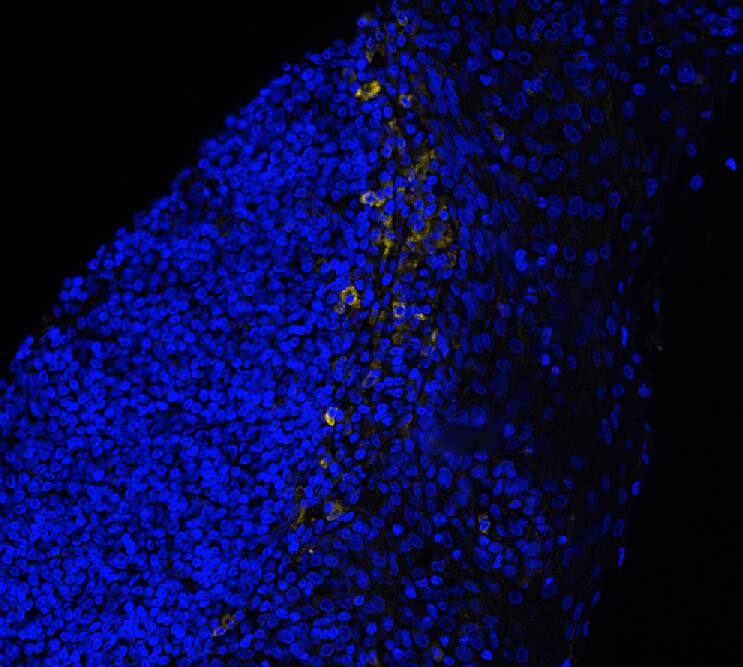 CD33 was detected in immersion fixed paraffin-embedded sections of human tonsil using Mouse Anti-Human CD33, Monoclonal Antibody (Catalog # MAB11371) at 15ug/mL at 37 ° Celsius for 4 minutes. Before incubation with the primary antibody, tissue underwent an all-in-one dewaxing and antigen retrieval preprocessing using PreTreatment Module (PT Module) and Dewax and HIER Buffer H (pH 9; Epredia Catalog # TA-999-DHBH). Tissue was stained using the Alexa Fluor™ 647 Goat anti-Mouse IgG Secondary Antibody at 1:200 at 37 ° Celsius for 2 minutes. (Yellow; Lunaphore Catalog # <A class=