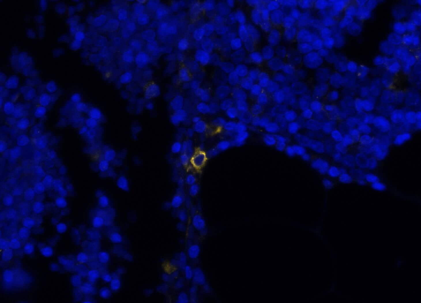 CD33 was detected in immersion fixed paraffin-embedded sections of human thymus using Mouse Anti-Human CD33, Monoclonal Antibody (Catalog # MAB11371) at 15ug/mL at 37 ° Celsius for 4 minutes. Before incubation with the primary antibody, tissue underwent an all-in-one dewaxing and antigen retrieval preprocessing using PreTreatment Module (PT Module) and Dewax and HIER Buffer H (pH 9; Epredia Catalog # TA-999-DHBH). Tissue was stained using the Alexa Fluor™ 647 Goat anti-Mouse IgG Secondary Antibody at 1:200 at 37 ° Celsius for 2 minutes. (Yellow; Lunaphore Catalog # <A class=